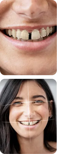 Simulation of dental procedures for smile enhancement.
